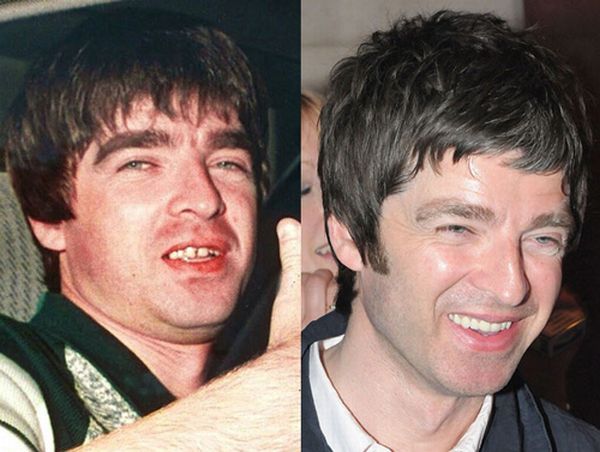 Звезды до и после стоматолога (10 фото)