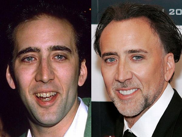 Звезды до и после стоматолога (10 фото)