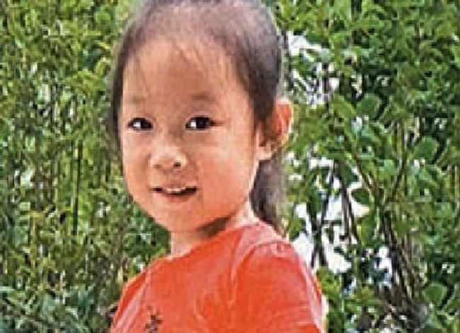 В Китае девочку избавили от огромного живота (4 фото)