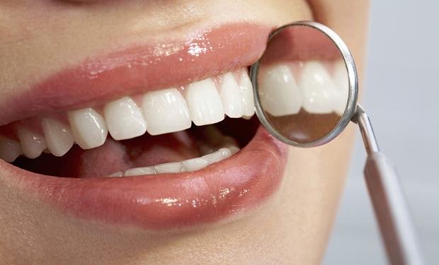 ТОП-5 советов как предотвратить разрушение зубов