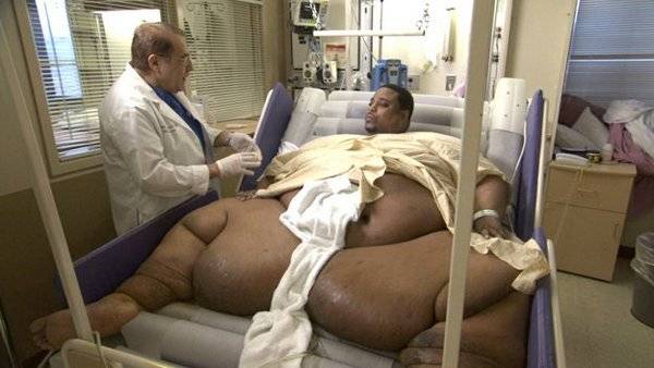 Самые тяжелые люди в мире (17 фото + текст)