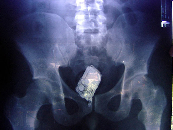 Cамые странные рентгеновские снимки