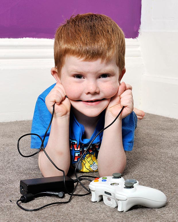 В Британии 5-летний мальчик каждый день питается проводами