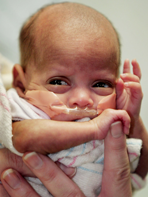Самые маленькие младенцы в мире (18 фото)