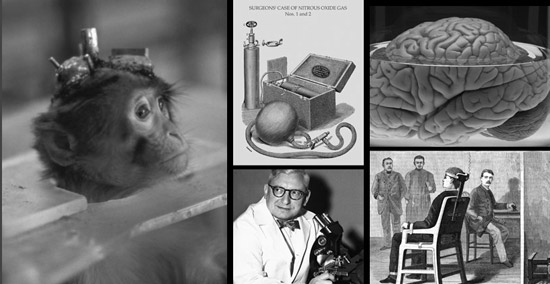 В 1970-х годах была проведена операция по пересадке головы обезьяны
