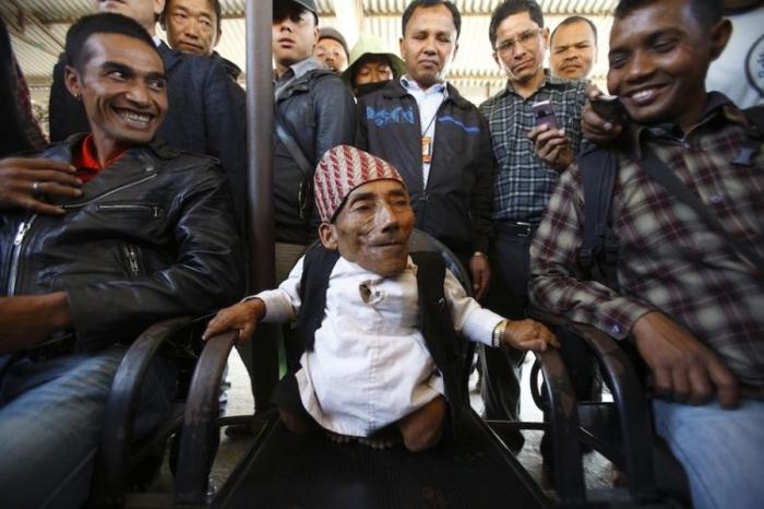 Самый маленький человек найден в непальской деревне (19 фото+видео)
