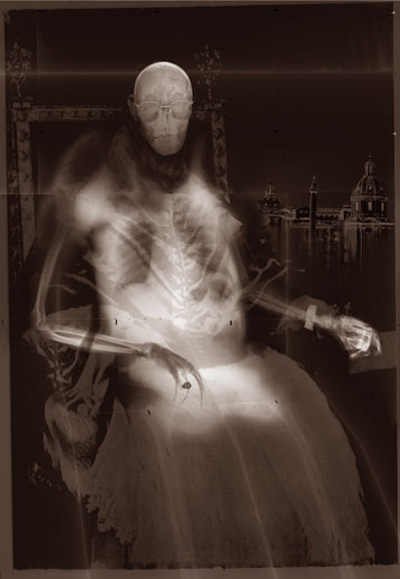Рентгенография Бенедетты Боники (12 фото)