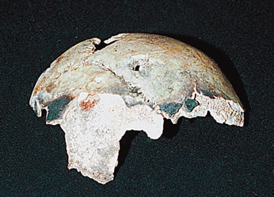 Череп, который, как считалось, принадлежал Адольфу Гитлеру, на самом деле был черепом 40-летней женщины