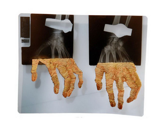Вышивка по рентгену (14 фото)