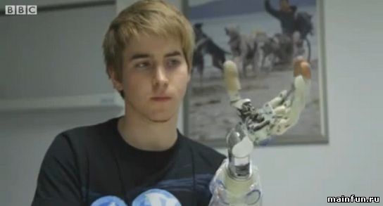 Первая в мире бионическая рука-протез