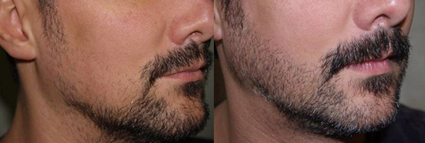 Как отрастить бороду за 90 дней?