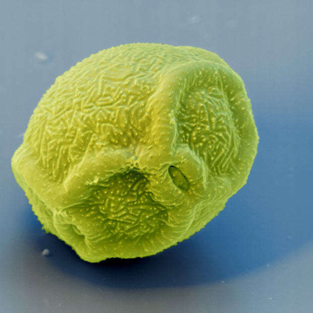 Частицы пыльцы и пыли под электронным микроскопом