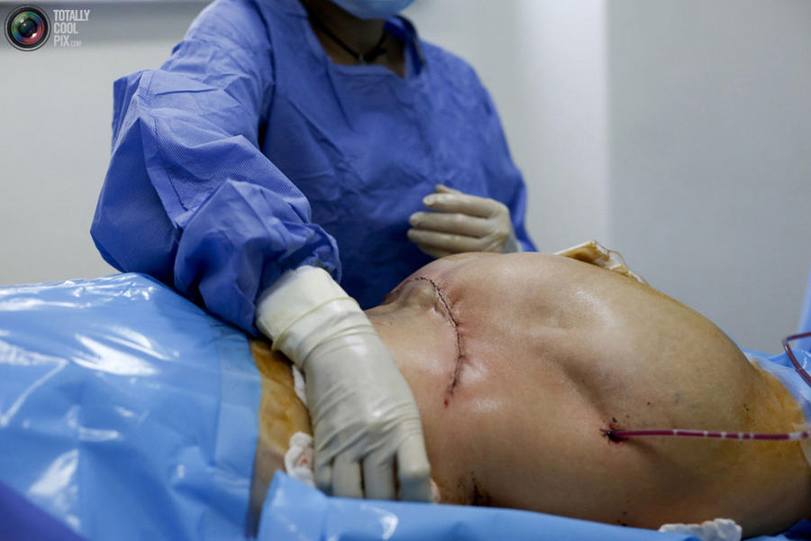 Восстановительная пластическая хирургия (30 фото)