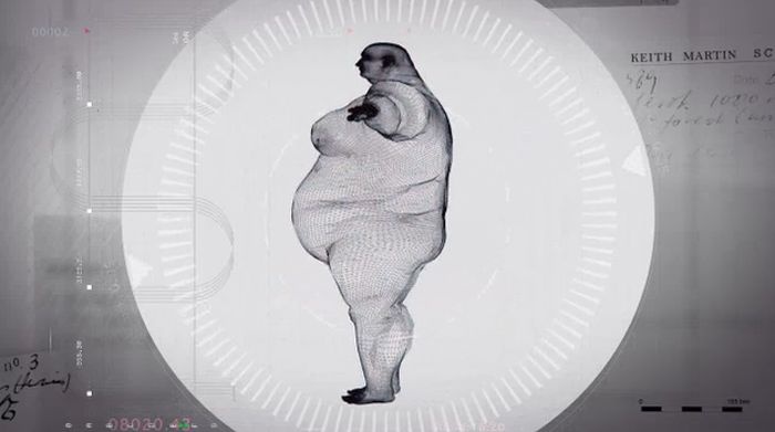 Рентгеновский снимок тела 400-килограммового мужчины (5 фото)
