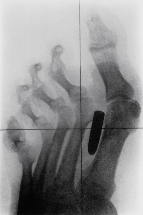 Жуткие рентгеновские снимки (22 фото)