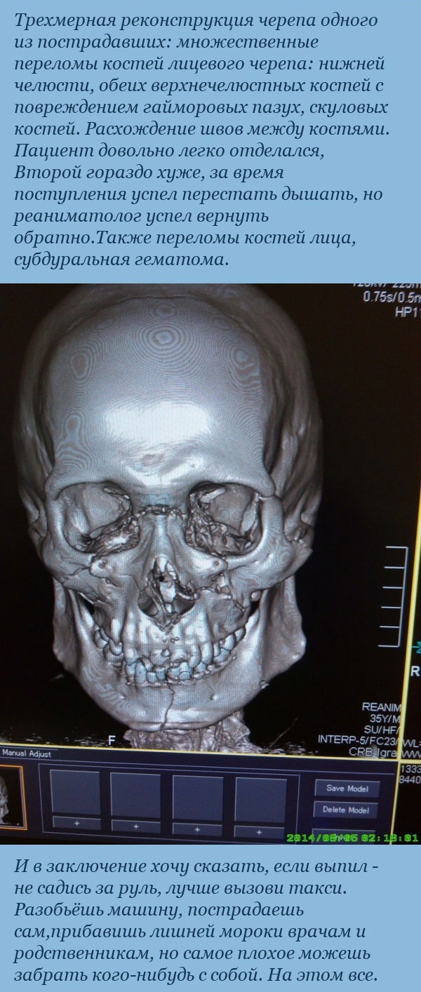 Врач-рентгенолог о пациентах с его ночного дежурства (6 фото)