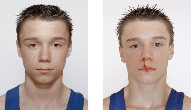 Юные боксеры: до и после боя (25 фото)