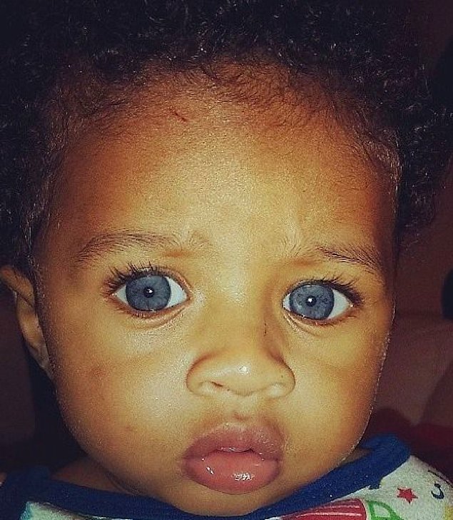 Африканские дети с голубыми глазами
