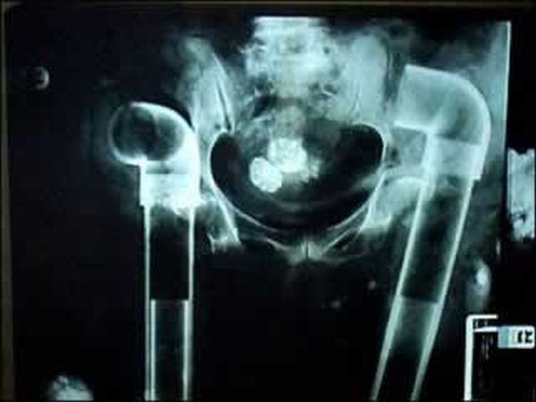 Жуткий рентген (20 фото)