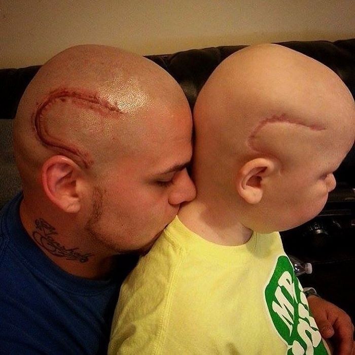 Отец сделал на голове татуировку в форме шрама своего сына