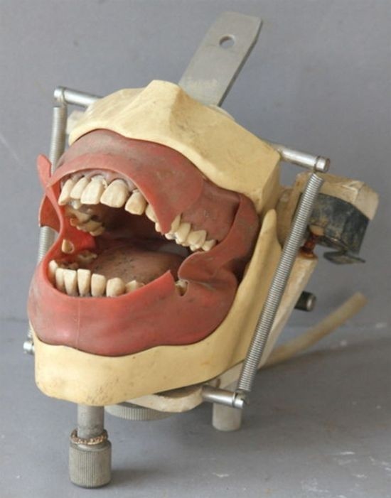 Жуткие стоматологические инструменты прошлых лет
