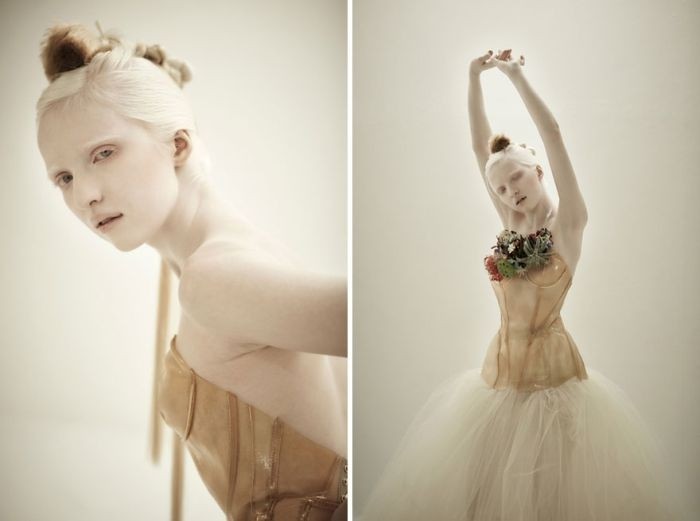 Уникальная красота людей-альбиносов