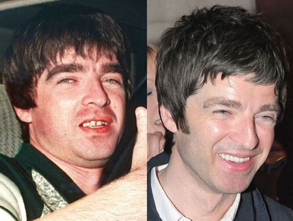 Звезды до и после стоматолога