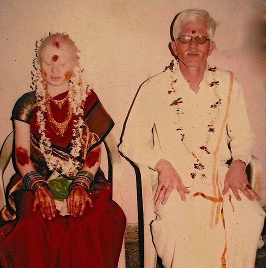 Индийская семья альбиносов (6 фото)