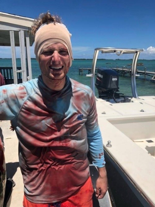 На Багамах дайвер заснял на видео, как на него напала акула (3 фото)