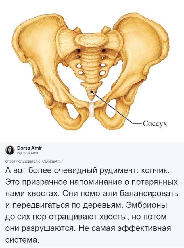 Какие органы в теле современного человека являются "лишними" (9 фото)