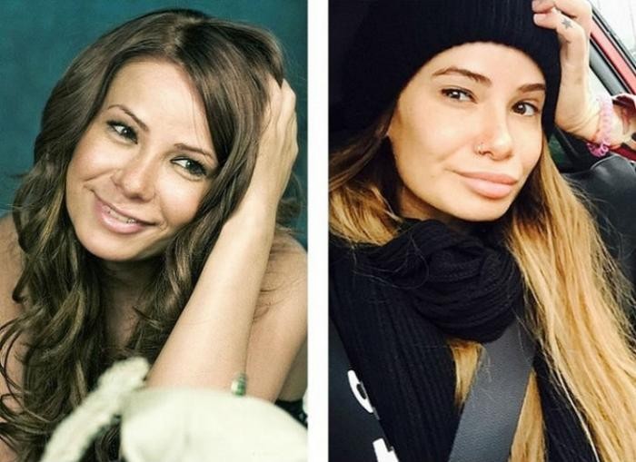 Известные российские красавицы до и после пластики (11 фото)
