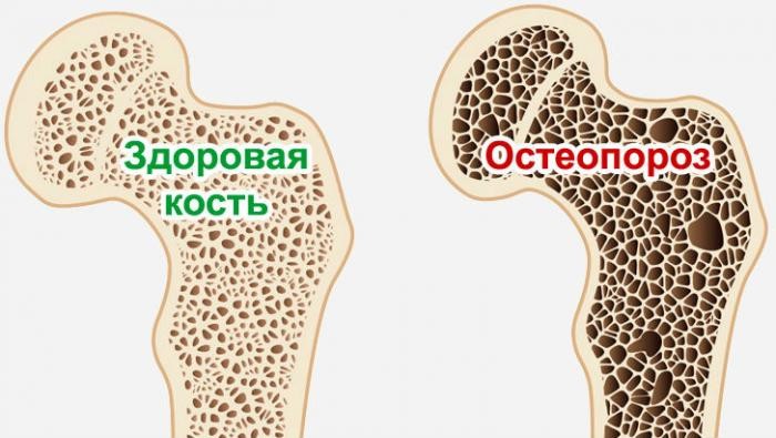 Жительнице Китая «постарела» на 30 лет из-за любви к кофе (4 фото)