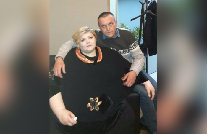 Самой тяжелой женщине России сделали операцию (3 фото)