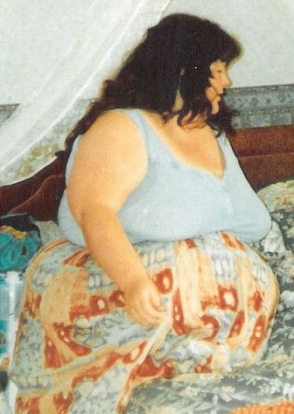 Женщина похудела, чтобы спасти свою жизнь (7 фото)