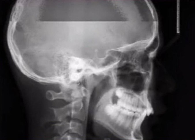 Как будет выглядеть рентген, если вы чихнете (2 фото)