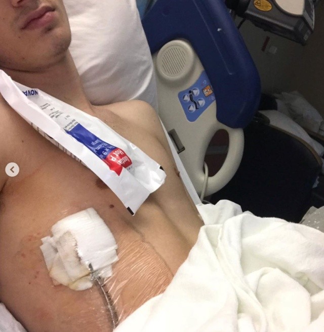 18-летний студент год курил вейп и попал на операционный стол (4 фото)