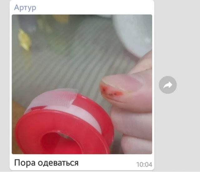 Порезанный палец стал героем мемов (7 фото)