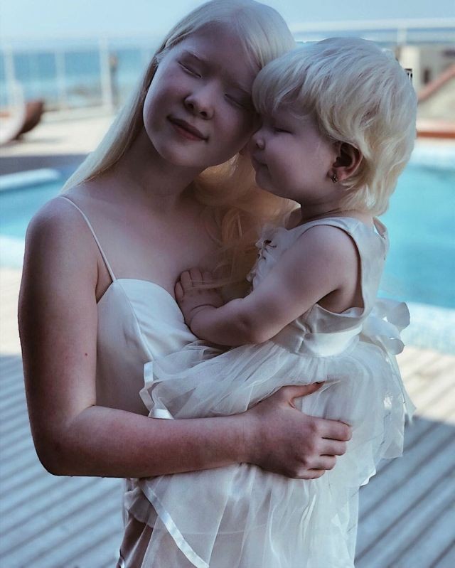 Асель и Камила - сестры-альбиносы из Казахстана (10 фото)