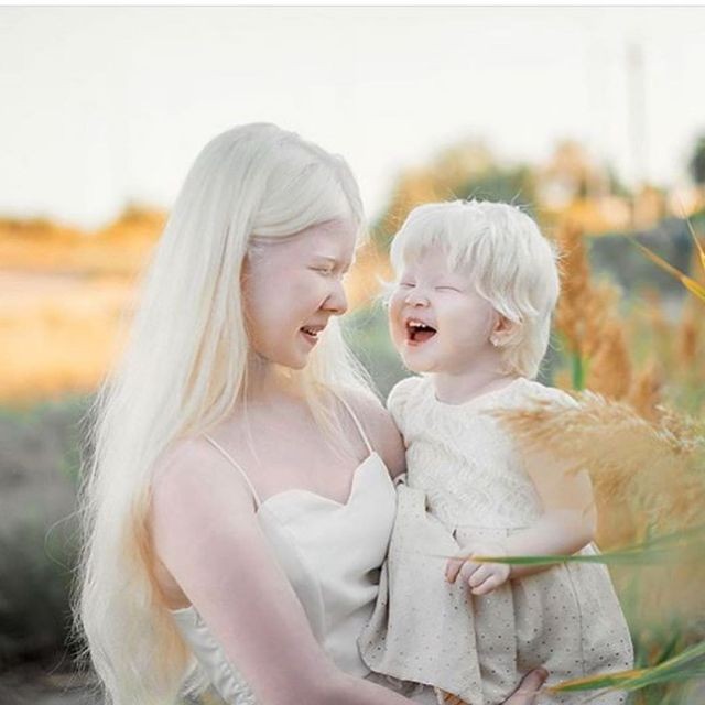Асель и Камила - сестры-альбиносы из Казахстана (10 фото)