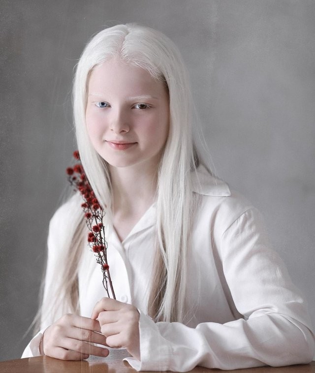 Амина Эпендиева - 11 летняя девочка из Чечни (7 фото)