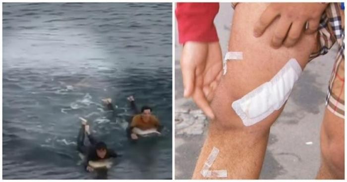 Австралийский серфер отбился от схватившей его за ногу акулы (3 фото)
