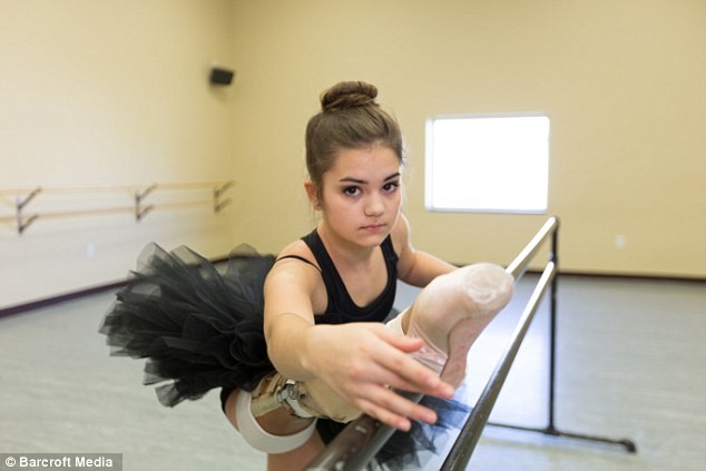 Девушка с протезом ноги стала прекрасной танцовщицей (8 фото)