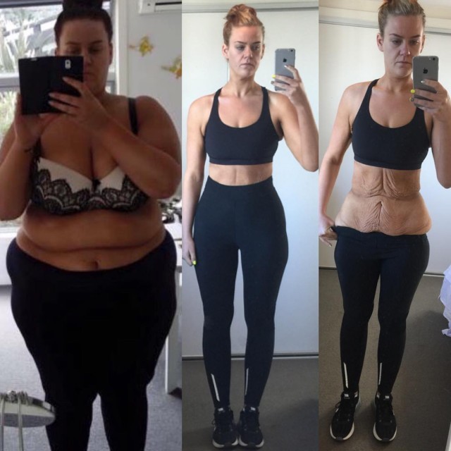 Девушка из Новой Зеландии скинула за 2 года 100 килограмм (15 фото)