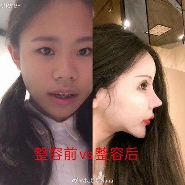 Звезда китайский соцсетей Little Z Nana: школьница перенесла сотню пластических операций, чтобы стать куклой (6 фото)