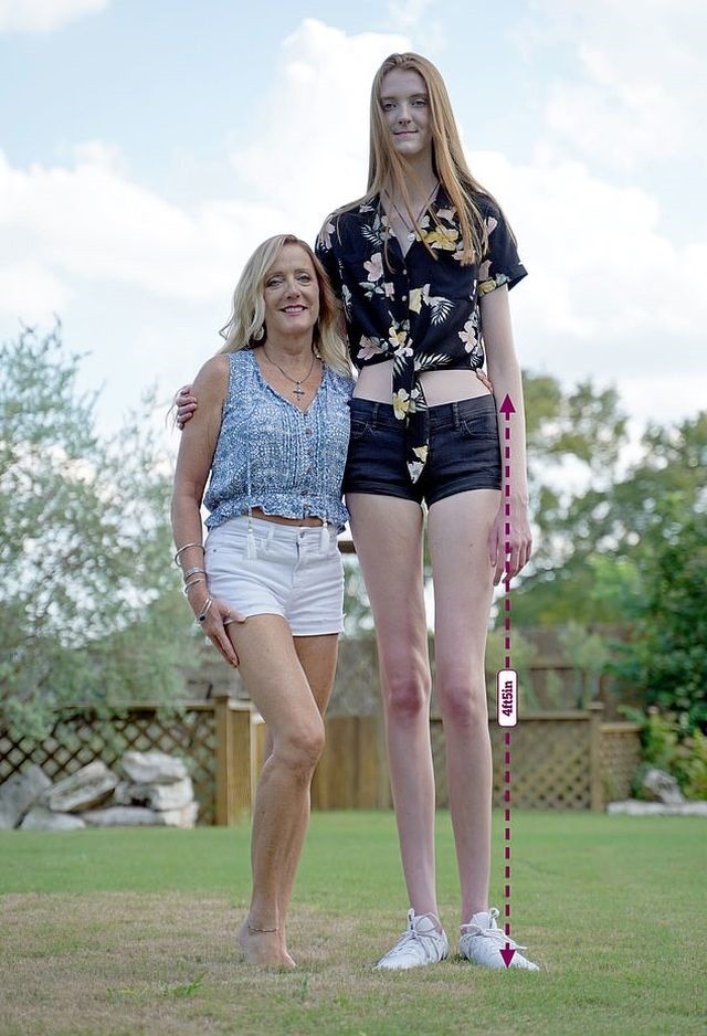 Маки Каррин - 17-летняя девушка с самыми длинными в мире ногами (13 фото)