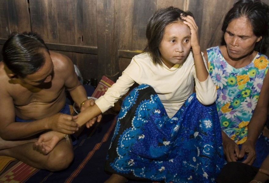 Печальная история камбоджийской девушки-обезьянки (7 фото)
