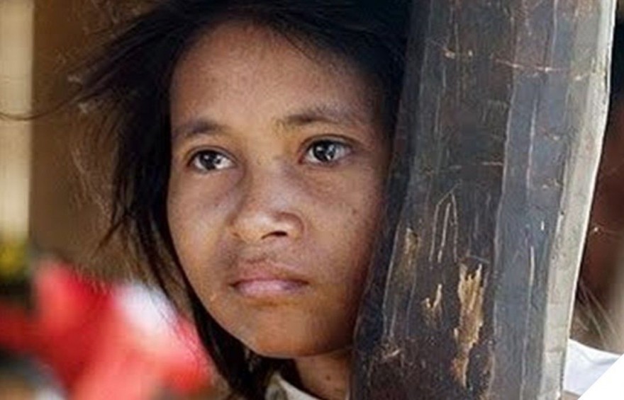Печальная история камбоджийской девушки-обезьянки (7 фото)