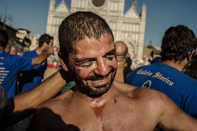 Италия: Как выглядит самая кровожадная разновидность футбола (40 фото)