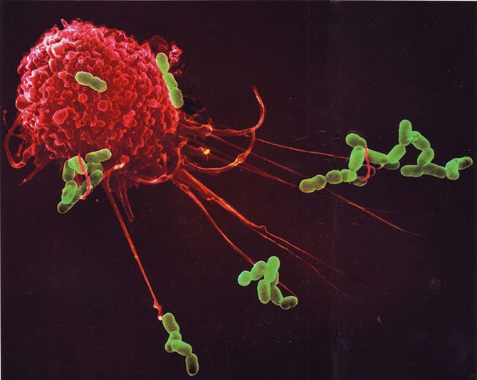 Наша невероятная иммунная система в микрофотографиях (17 фото)
