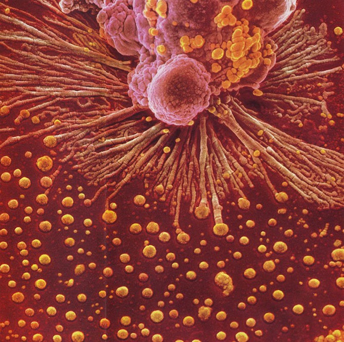 Наша невероятная иммунная система в микрофотографиях (17 фото)